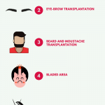 DHI Hair Transplant – Cosmeticium