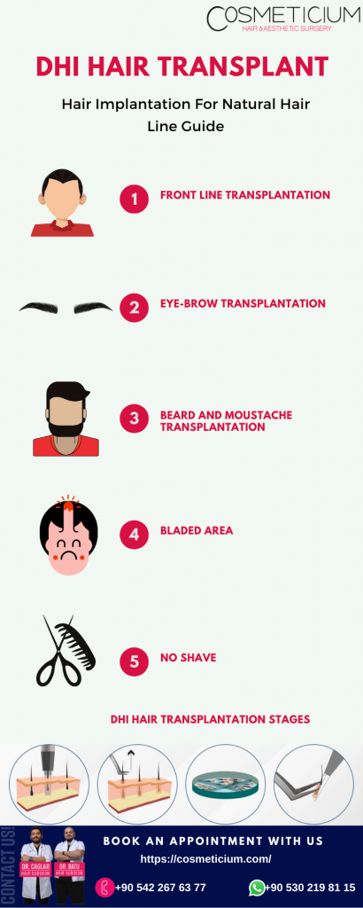 DHI Hair Transplant – Cosmeticium